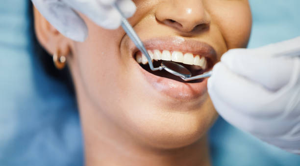 Best Emergency Dentist for Knocked-Out Tooth in Jefferson City, MO
