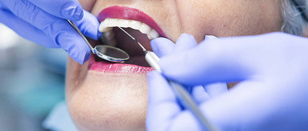 Best Emergency Dentist for Lost Fillings or Crowns in Jefferson City, MO